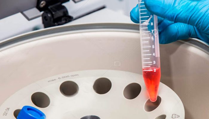 AKM_Frecuencia_pagina